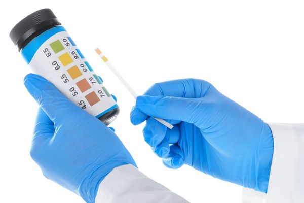 کدام چربی گیر برای خط تولید شما مناسب تر است؟
